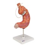 Stomach Model with Gastric Band, 2 part - 3B Smart Anatomy