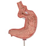 Stomach Model with Gastric Band, 2 part - 3B Smart Anatomy