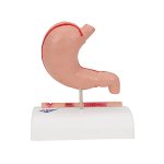 Stomach Section Model with Ulcers - 3B Smart Anatomy