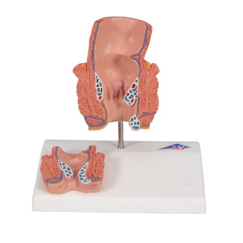Hämorrhoiden-Modell- 3B Smart Anatomy