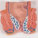 Hämorrhoiden-Modell- 3B Smart Anatomy