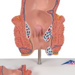 Hämorrhoiden-Modell- 3B Smart Anatomy