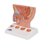 Prostate Model, 1/2 Life-Size - 3B Smart Anatomy