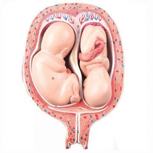 Twin Fetuses Model, 5th Month in Normal Position - 3B Smart Anatomy