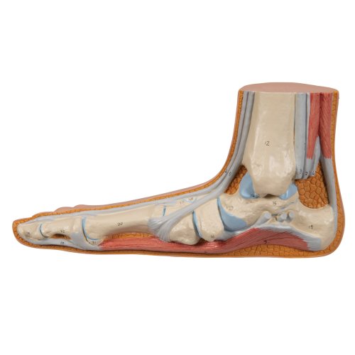 Flat Foot (Pes Planus) Model - 3B Smart Anatomy