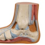 Fuß-Modell Plattfuß - 3B Smart Anatomy