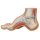 Hollow Foot (Pes Cavus) Model - 3B Smart Anatomy