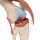 Knee Joint Functional Model with Ligaments &amp; Marked Cartilage - 3B Smart Anatomy