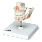 Milk Denture Model with Remaining Teeth - 3B Smart Anatomy