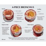 4-Piece Bronchus Model