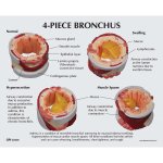 4-Piece Bronchus Model