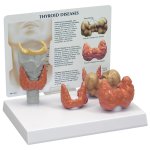 Thyroid Model