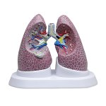 Lungen-Modell Set mit Pathologien