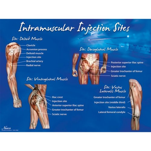 Intramuscular Injection Sites Poster