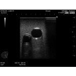 CVC Insertion Simulator III