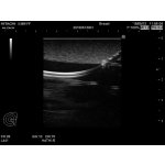 CVC Insertion Simulator III