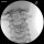 Bildgestützter HWS-Injektionstrainer