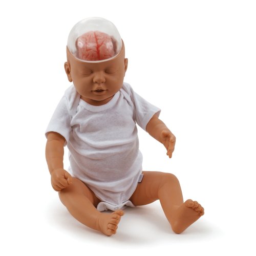 Schütteltrauma (SBS) Model