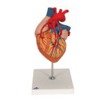 Herz-Modell mit Bypass, 2-fache Größe, 4-tlg -...