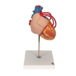 Heart Model with Bypass, 2x magnified, 4 part - 3B Smart Anatomy