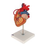 Heart Model with Bypass, 2x magnified, 4 part - 3B Smart Anatomy