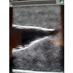 Ultrasound trainer dog bladder