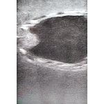 Hundeblase Ultraschalltrainer