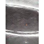 Hundeblase Ultraschalltrainer