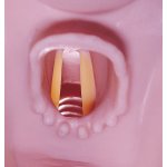 Airway Larry Head