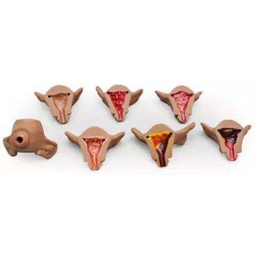 ZOE Uteri Set, Interne Phatologien