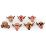 ZOE Uteri Set, Internal Phatalogies