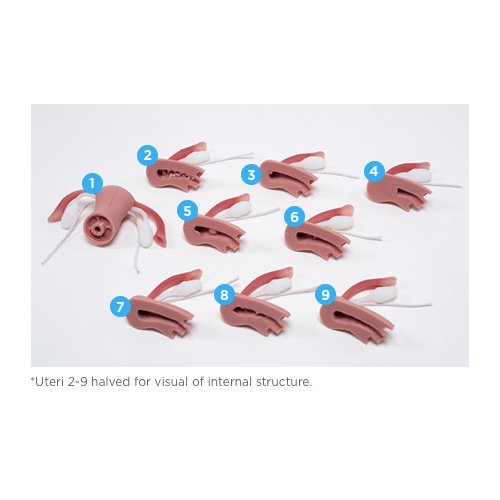 ZOE Uteri mit normalen und abnormalen inneren Pathologien