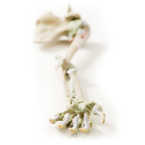 3D Upper arm - ligaments model