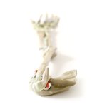 3D Upper arm - ligaments model