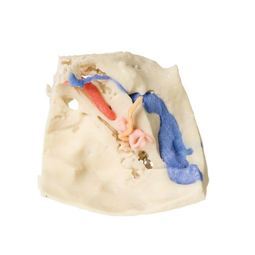 3D Schläfenbein Modell, 3er-Set