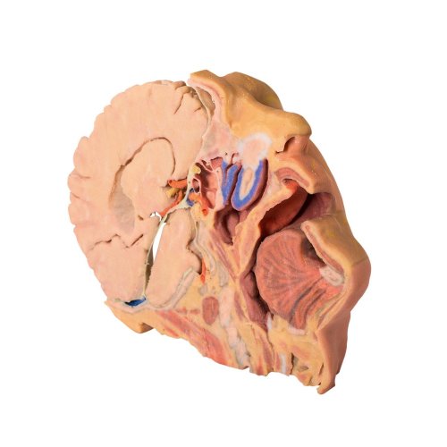 3D Head and neck model