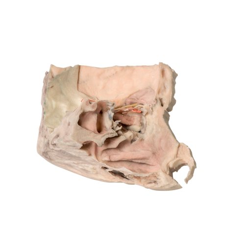 3D Mediale Orbita Modell