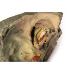 3D Medial orbit model