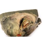 3D Mediale Orbita Modell