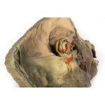 3D Mediale Orbita Modell