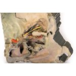 3D Mediale Orbita Modell