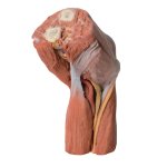 3D Fossa cubitalis Modell - Muskeln, gro&szlig;e Nerven und Arteria brachialis
