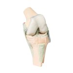 3D Kniegelenk Modell, gebeugt