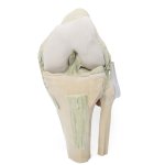3D Knee joint model, flexed