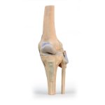 3D Knee joint model, extended