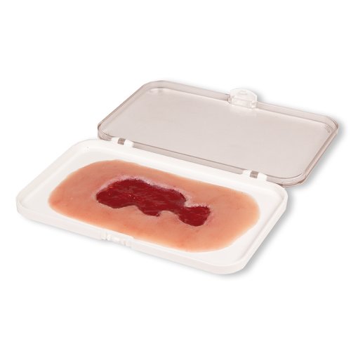 Wound moulage venous leg ulcer, small, granulation phase