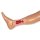 Wound moulage venous leg ulcer, small, granulation phase