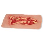 Wound moulage venous leg ulcer, large, exudation phase