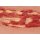Wound moulage venous leg ulcer, large, exudation phase