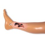 Wundmoulage Ulcus Cruris Arteriosum, klein, Exsudationsphase
